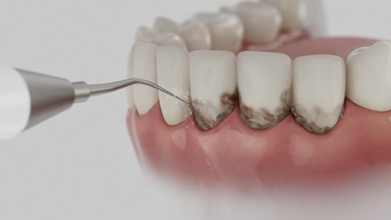 Reliable Teeth Cleaning And Checkup contractor in Broomfield County County, CO by Dentist Open Now